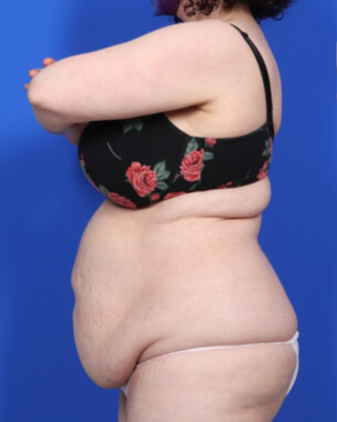 Case # 63 before photo