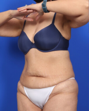 Case # 64 before photo