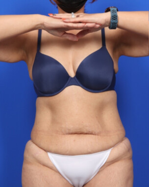 Case # 64 before photo