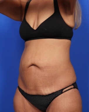 Case # 67 before photo