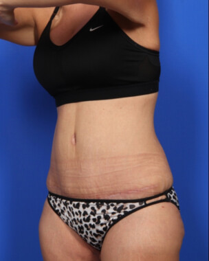 Case # 67 after photo