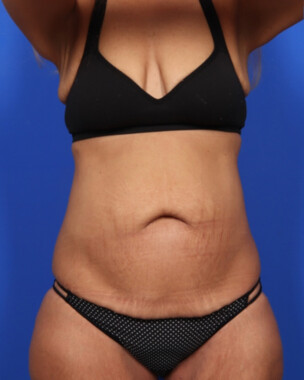 Case # 67 before photo