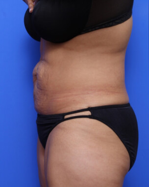 Case # 68 before photo