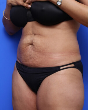 Case # 68 before photo