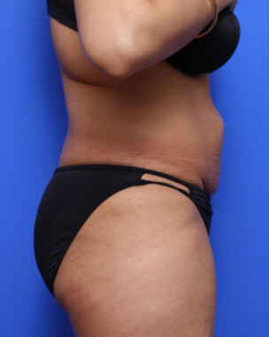 Case # 68 before photo