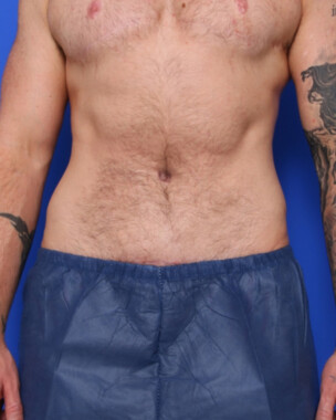 Case # 1 after photo