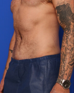 Case # 1 after photo