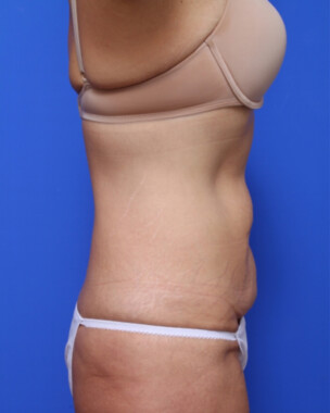 Case # 5 before photo