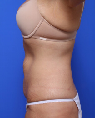 Case # 5 before photo