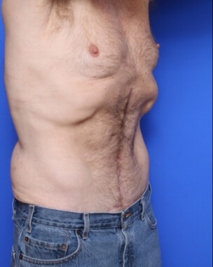 Case # 2 after photo