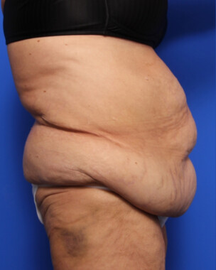 Case # 73 before photo