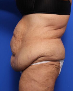 Case # 73 before photo