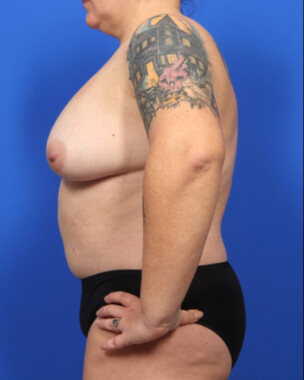 Case # 78 after photo