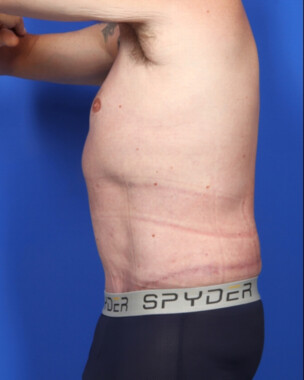 Case # 3 after photo