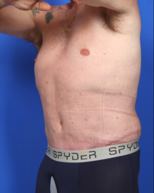 Case # 3 after photo