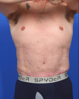 Case # 3 after photo