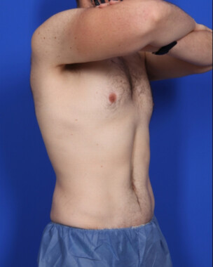 Case # 4 after photo