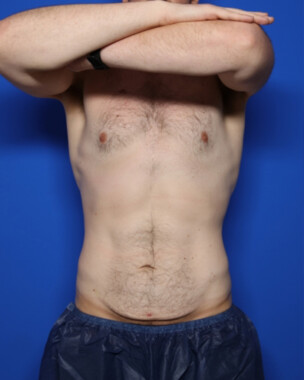 Case # 4 before photo