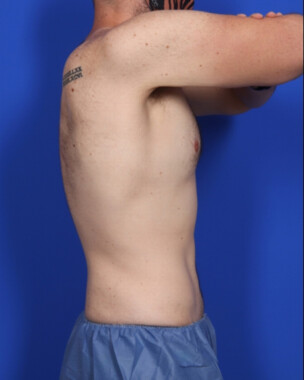 Case # 4 after photo