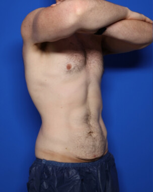 Case # 4 before photo