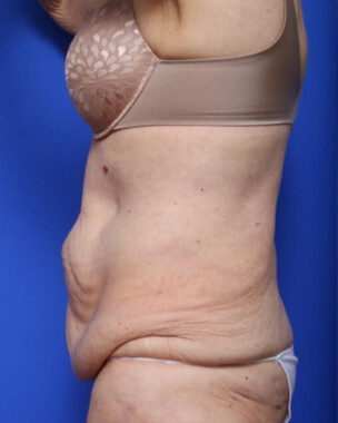 Case # 3 before photo