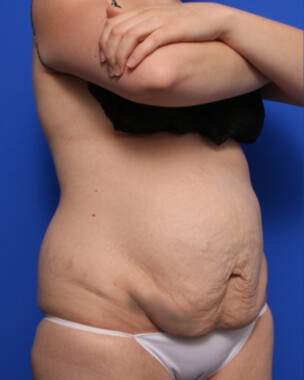 Case # 97 before photo