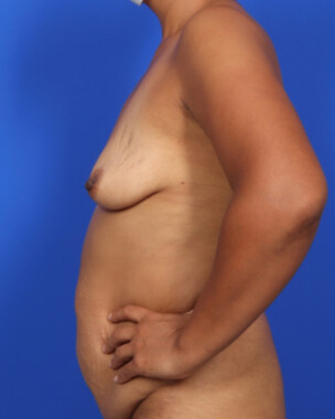 Case # 99 before photo