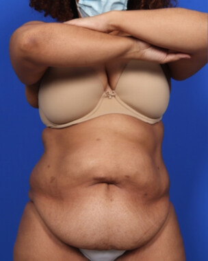 Case # 5 before photo