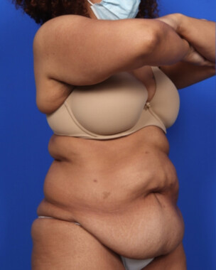 Case # 5 before photo