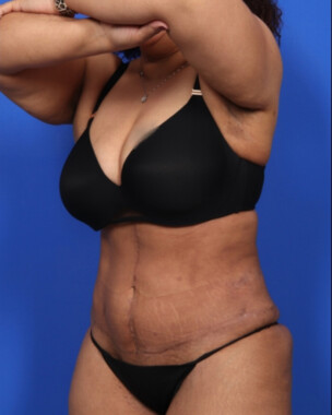 Case # 5 after photo