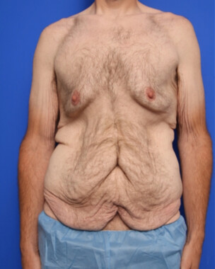 Case # 5 before photo