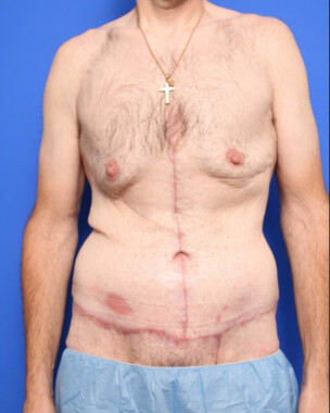 Case # 5 after photo