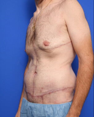 Case # 5 after photo