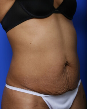 Case # 100 before photo