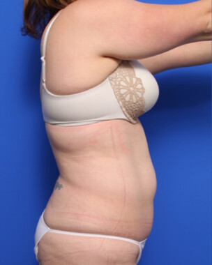 Case # 105 before photo