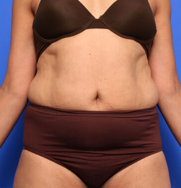 Case # 2 after photo