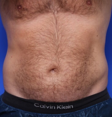 Case # 3 before photo