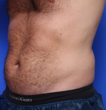 Case # 3 before photo