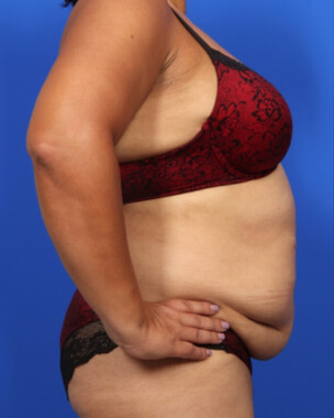 Case # 118 before photo