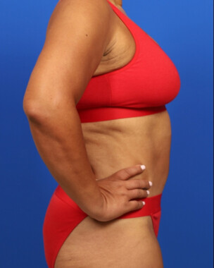 Case # 118 after photo