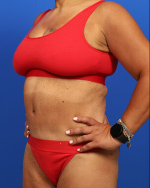 Case # 118 after photo