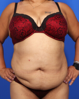 Case # 118 before photo