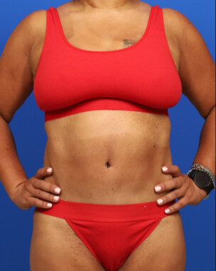 Case # 118 after photo