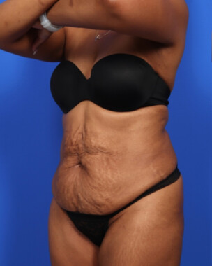 Case # 121 before photo