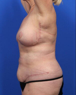 Case # 6 after photo