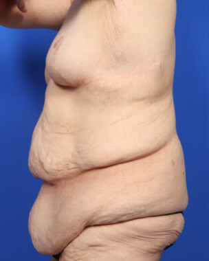 Case # 7 before photo