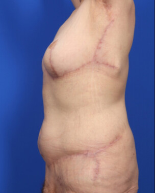 Case # 7 after photo