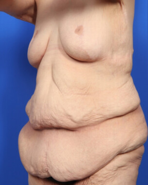 Case # 7 before photo