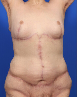 Case # 7 after photo