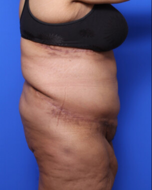 Case # 8 after photo